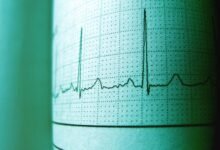 short call frequency analysis